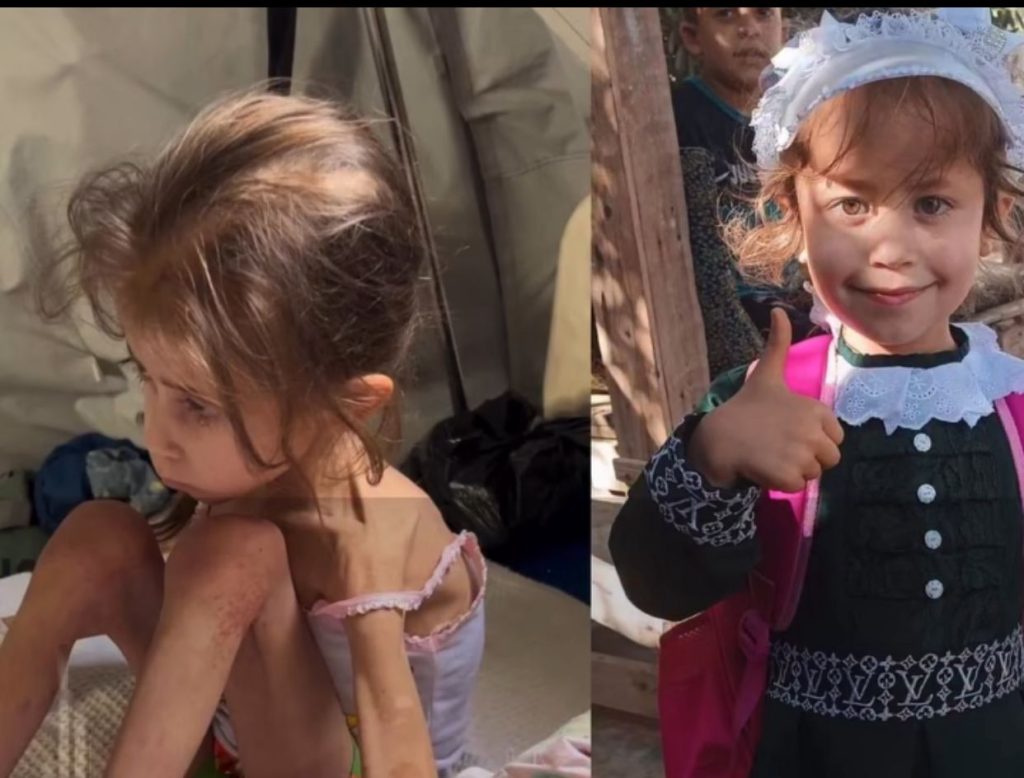 جنى عياد تواجه الموت جوعا في غزة
