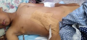 شظية غادرة تصيب محمد السلوت بالشلل