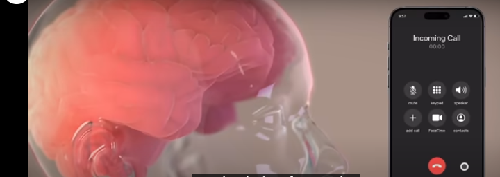 زراعة شرائح دماغية لمرضى الشلل الرباعي