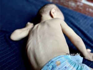 أطفال غزة يواجهون الموت في ظل استمرار حصار القطاع