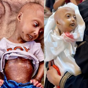 وفاة الطفلة حلا الهنادي بعد صراع مع المرض