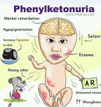 الفينيل كيتونوريا اضطراب وراثي نادر يصيب الأطفال