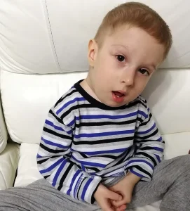 يعاني تيموفي بافلينكو، البالغ من العمر عامين، من خلل التنسج الليفي المعظم التقدمي (FOP)