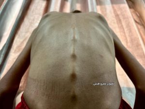 بيان.. لم تعد قادرة على الحركة