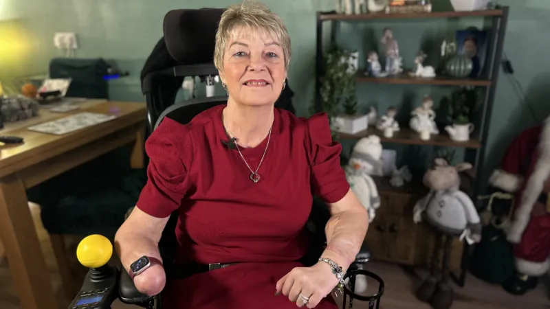 عملية زرع يد