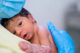 الأطفال الخدج معرضون لإعاقات مستمرة وطويلة