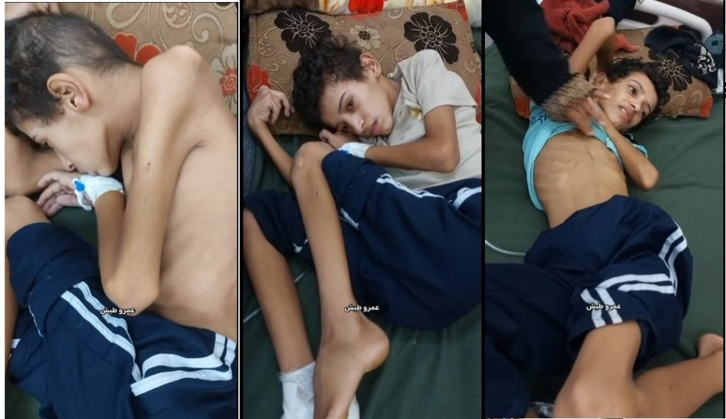 الطفل يوسف أبو عمرة