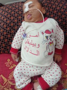 الطفلة جنة مطير بين الحياة والموت