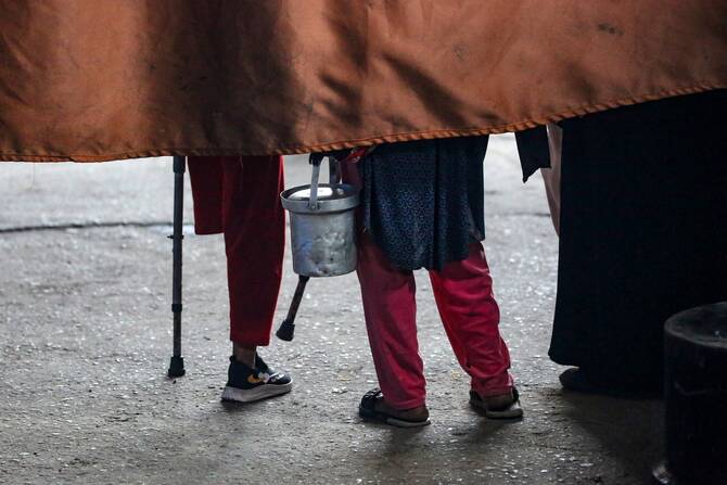 تزايد حالات بتر الأطراف في غزة بسبب الحرب