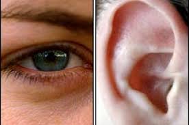 متلازمة أشر إعاقة تصيب البصر والسمع منذ الولادة