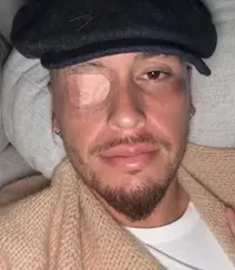 إصابة أوكامبوس بالشلل