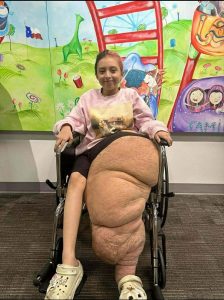 بتر ساق ياسمين