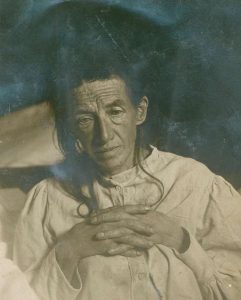 مريضته الشهيرة أوغست ديتر