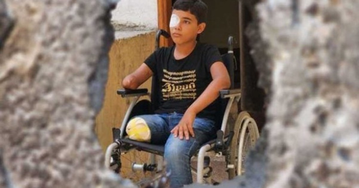 عملية الرصاص المصبوب