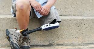 تزايد أعداد ذوي الإعاقة ومبتوري الأطراف حول العالم بسبب الألغام الأرضية