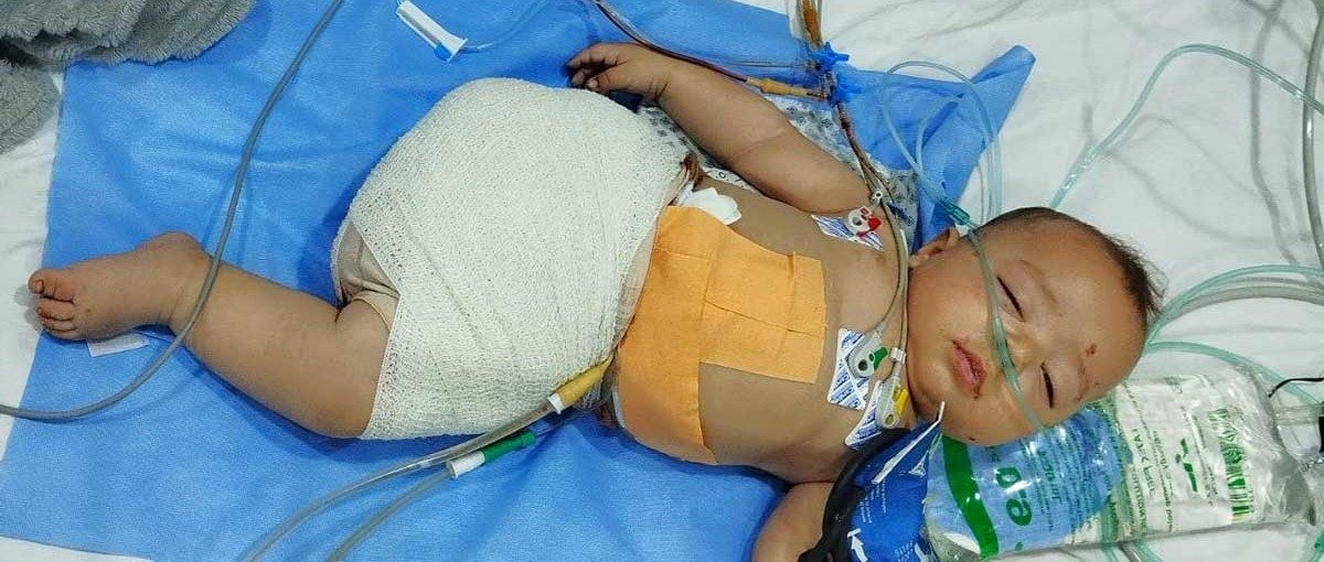 رضيع فلسطينى فقد ساقه قبل أن يرى الدنيا علي يد جيش الاحتلال