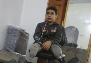 6 آلاف مبتور أطراف في غزة 25% منهم أطفال