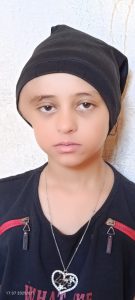 مريم قبل إجراء الجراحة فى الجمجمة