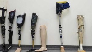 مصر تنوي توطين صناعة الأجهزة التعويضية