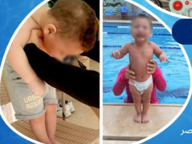 ذوي التأخر الحركي