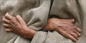 مرضى الجذام في مصر