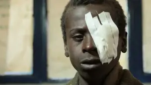 العمى يهدد نصف سكان العالم