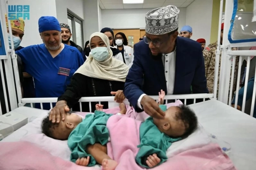 فصل التوأم الصومالي «رحمة ورملا»